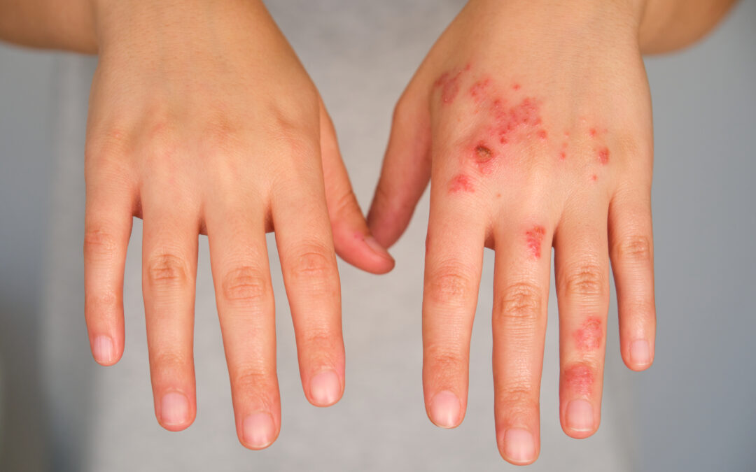 Nino Mai Arbeitsschutz GmbH: Skin Protection for the Real Estate Industry